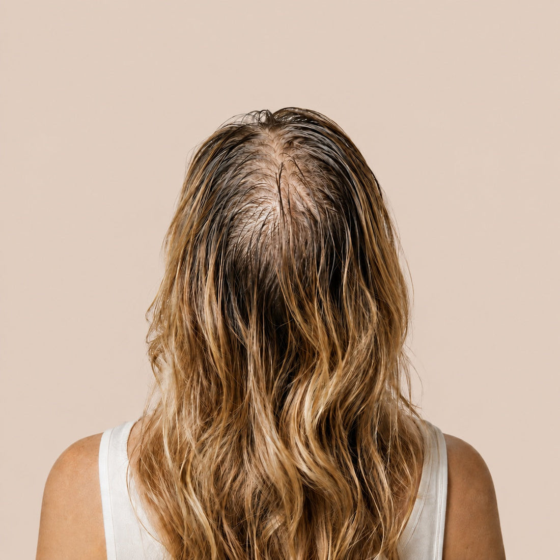 Thinning Hair