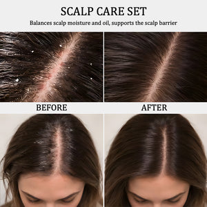 Oil-Control Scalp Care Duo