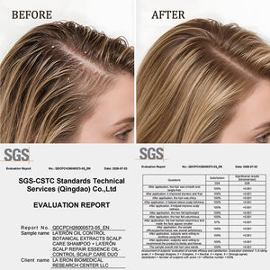 Oil-Control Scalp Care Duo