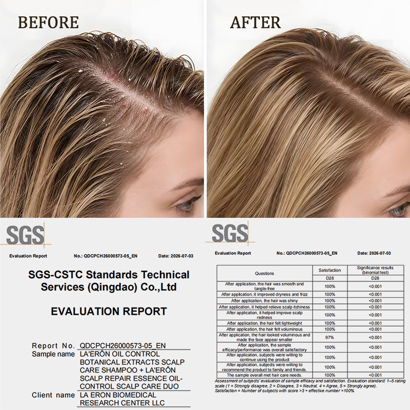 Oil-Control Scalp Care Duo