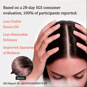 Oil-Control Scalp Care Duo
