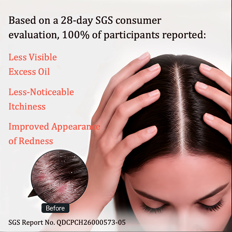 Oil-Control Scalp Care Duo