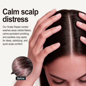 SCALP REPAIR ESSENCE